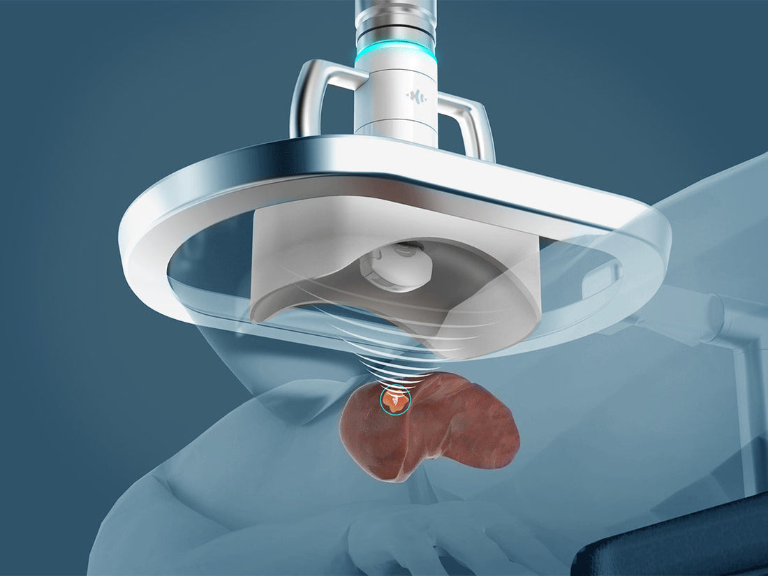 Why Hong Kong Is the Only Place in Asia Offering Histotripsy — And Why It Matters for Patients Who Can’t Undergo Surgery